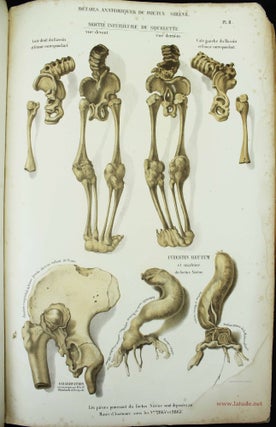 Musée d'anatomie de la Faculté de médecine de Strasbourg. Description de deux foetus monstres, dont l'un acéphale et l'autre monopode.