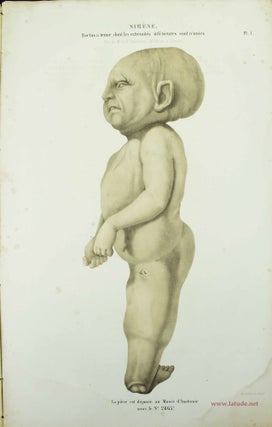 Item #11498 Musée d'anatomie de la Faculté de médecine de Strasbourg. Description de deux...