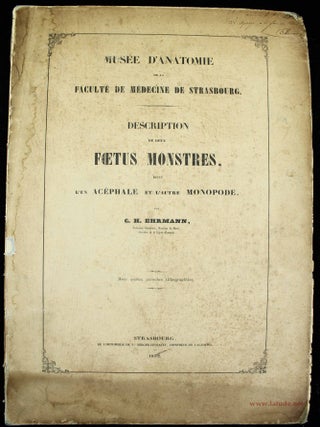 Musée d'anatomie de la Faculté de médecine de Strasbourg. Description de deux foetus monstres, dont l'un acéphale et l'autre monopode.
