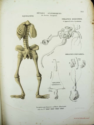 Musée d'anatomie de la Faculté de médecine de Strasbourg. Description de deux foetus monstres, dont l'un acéphale et l'autre monopode.