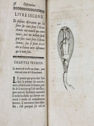 Observations sur la pratique des accouchemens, naturels, contre nature & monstrueux.