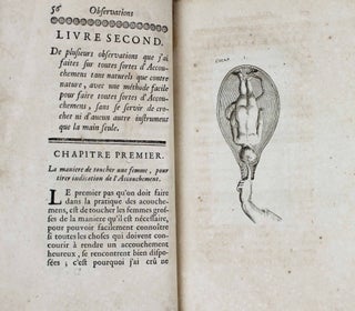 Observations sur la pratique des accouchemens, naturels, contre nature & monstrueux.