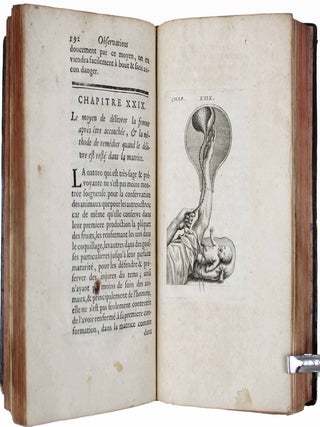 Observations sur la pratique des accouchemens, naturels, contre nature & monstrueux.
