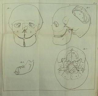 Item #13887 Description anatomique d'une tête humaine extraordinaire, suivie d'un essai sur...