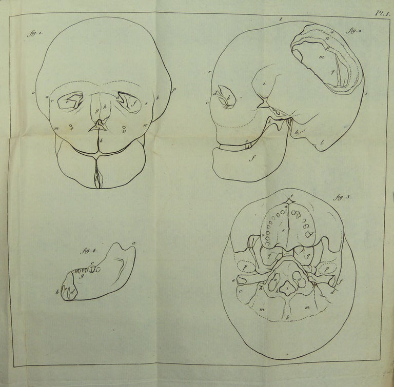 Item #13887 Description anatomique d'une tête humaine extraordinaire, suivie d'un essai sur l'origine des nerfs. JADELOT.