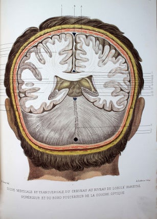 Item #14969 Atlas d'anatomie topographique du cerveau et des localisations cérébrales. E. GAVOY