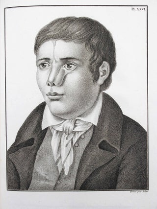 Chirurgie clinique de Montpellier, ou observations et r&eacute;flexions tir&eacute;es des travaux de. Jacques DELPECH.