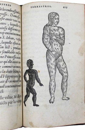 Item #16758 Deux livres de chirurgie. I. De la génération de l'homme & manière d'extraire les...