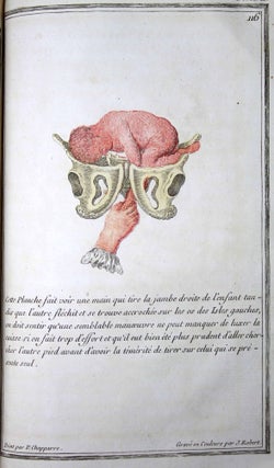 Abrégé de l'art des accouchements, dans lequel on donne les préceptes nécessaires pour le mettre heureusement en pratique, & auquel on a joint plusieurs observations intéressantes sur des cas singuliers. Ouvrage très utile aux jeunes sages-femmes, & généralement à tous les élèves en cet art, qui désirent de s'y rendre habiles. Nouvelle édition, avec figures gravées en taille-douce & imprimées en couleurs.