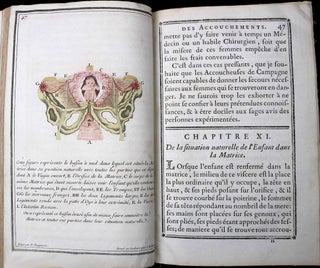 Abrégé de l'art des accouchements, dans lequel on donne les préceptes nécessaires pour le mettre heureusement en pratique, & auquel on a joint plusieurs observations intéressantes sur des cas singuliers. Ouvrage très utile aux jeunes sages-femmes, & généralement à tous les élèves en cet art, qui désirent de s'y rendre habiles. Nouvelle édition, avec figures gravées en taille-douce & imprimées en couleurs.