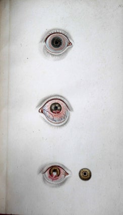 Traité de l'ophtalmie, la cataracte et l'amaurose pour servir de supplément au traité des maladies des yeux de Weller